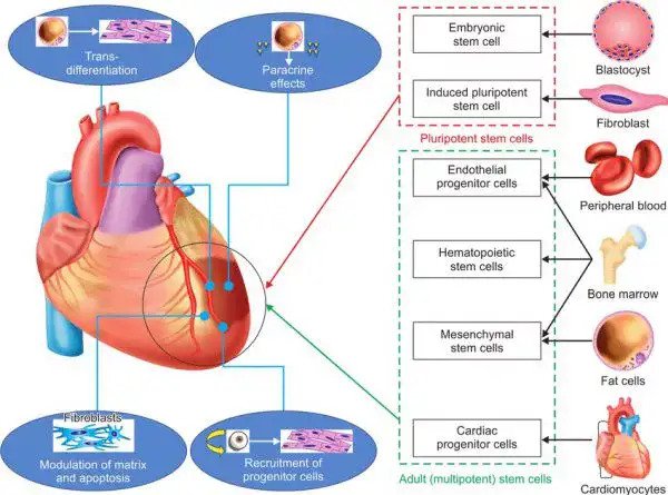 โรคหลอดเลือดหัวใจ HEART DISEASE